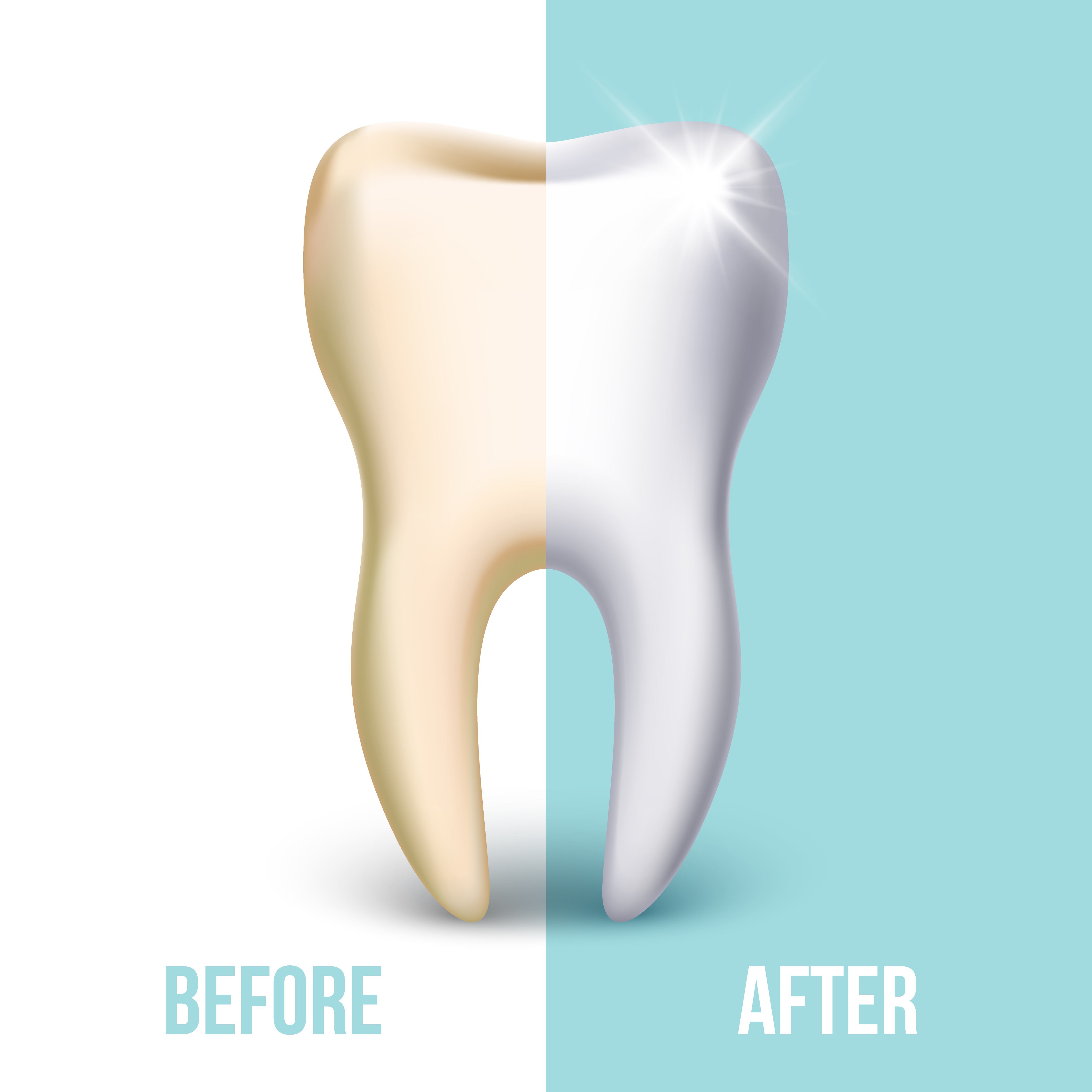 teeth whitening