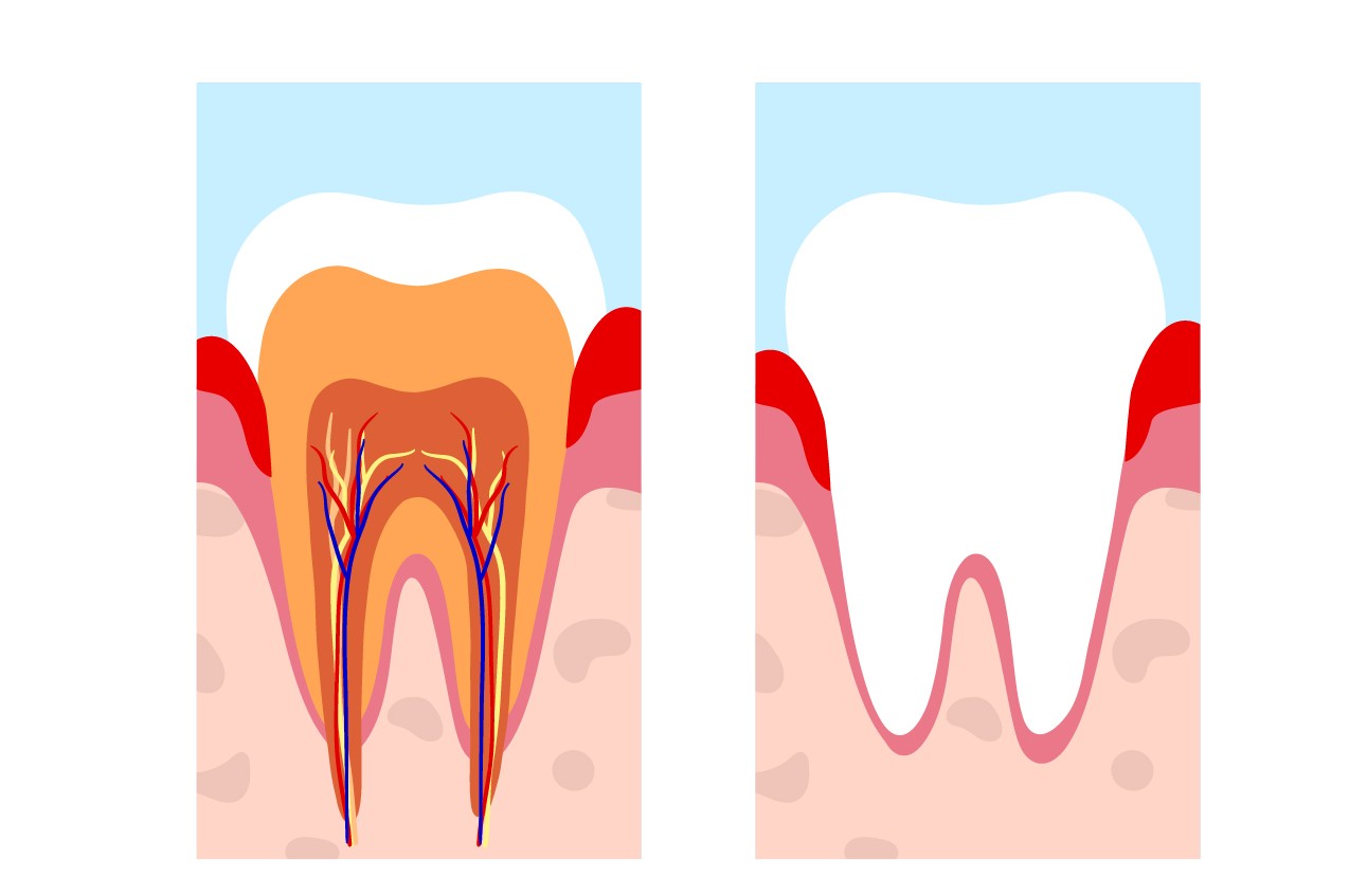 Gum treatment